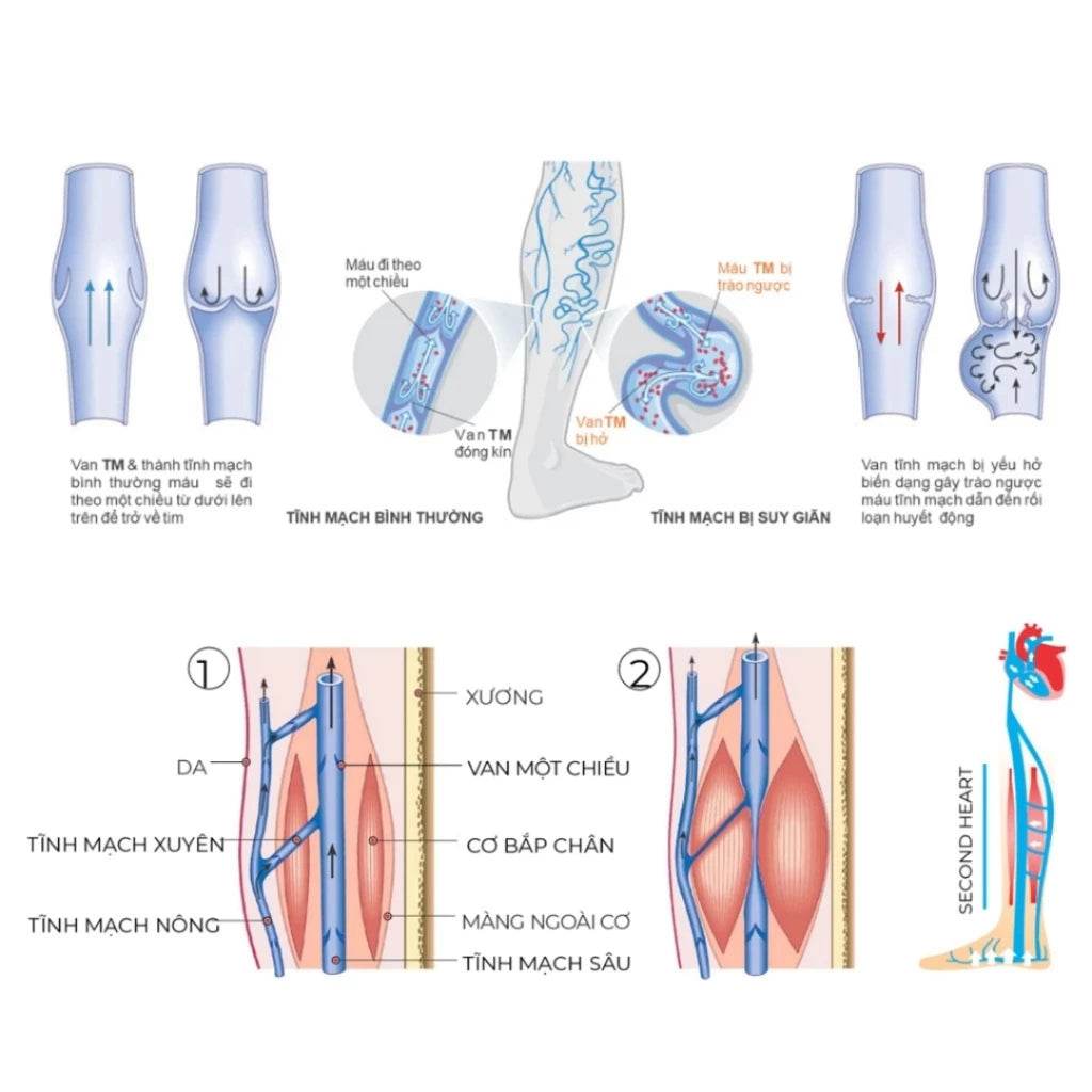 Vớ, Tất y khoa SANKOM - Giúp giảm suy giãn tĩnh mạch - Cho nam và nữ - Thụy Sĩ - ABcare