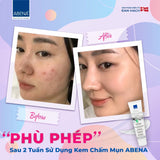 Kem đa năng Abena Zinc Ointment - Nhập Khẩu Đan Mạch - Chăm sóc các vùng da bị tổn thương như chàm, mụn trứng cá